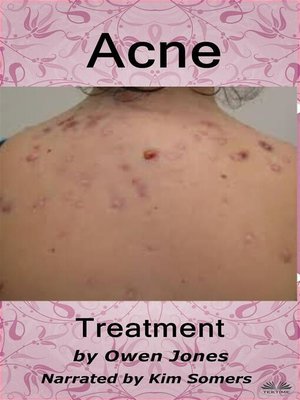 cover image of Acne Treatment